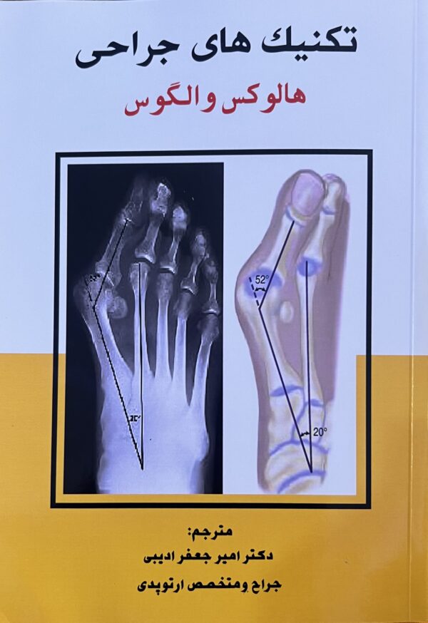 کتاب تکنیک های جراحی هالوکس والکوس ترجمه امیر جعفر ادیبی
